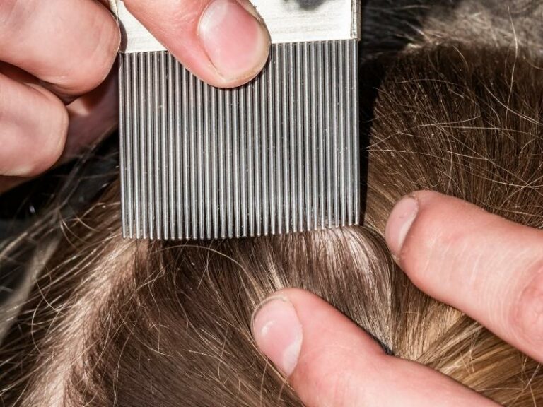 Вивести воші в домашніх умовах: ефективні методи 2026