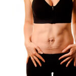 Діастаз прямих м’язів живота: що це та як з цим жити