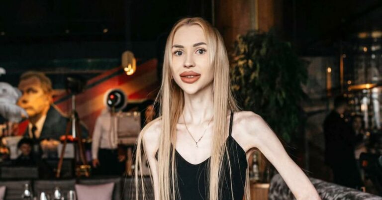 Найхудіша людина у світі: неймовірні долі та приховані причини