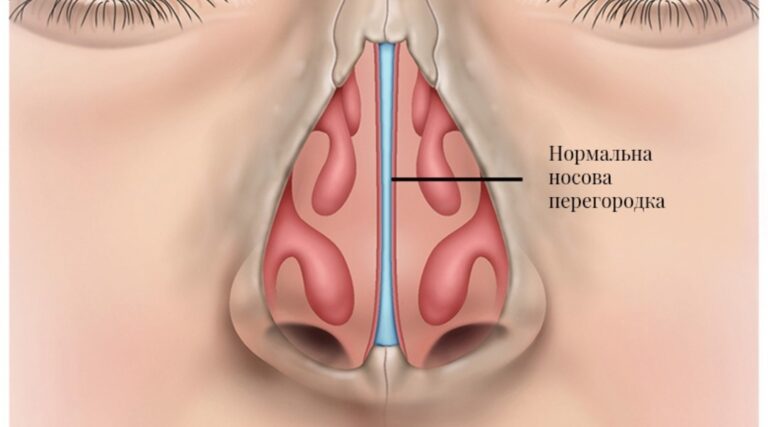 Чому пересихає в носі: причини, симптоми та ефективні рішення
