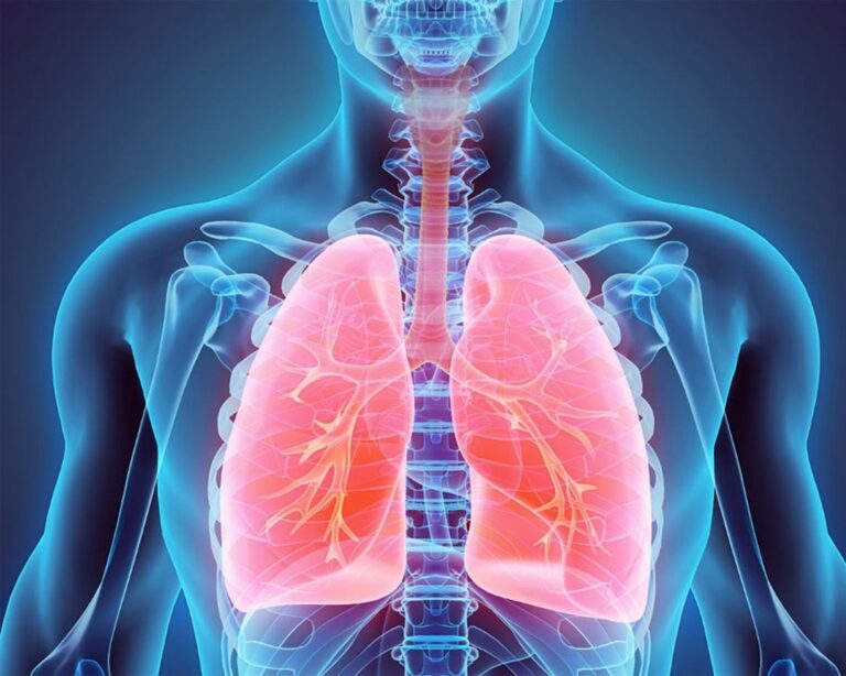 Чи лікується пневмофіброз: правда про рубці в легенях і шляхи полегшення