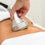 Чи шкідлива кавітація: правда про ультразвукову процедуру