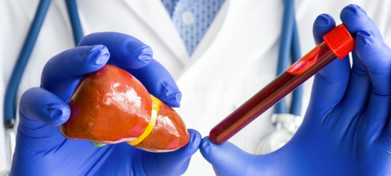 Як знизити білірубін: дієта, ліки та способи життя